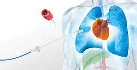 Hemodynamic Monitoring of Critical Care Patients