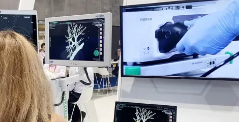 The launch of the new scope - the EB-710P Slim Bronchoscope, 9th of September 2022, Barcelona