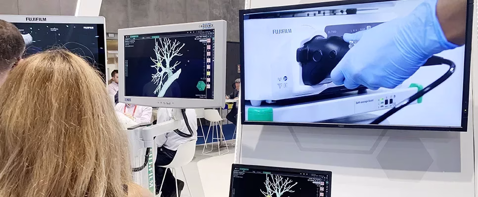The launch of the new scope - the EB-710P Slim Bronchoscope, 9th of September 2022, Barcelona
