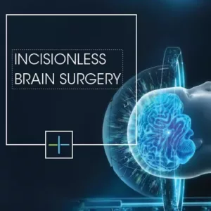 Incisionless Brain Surgery