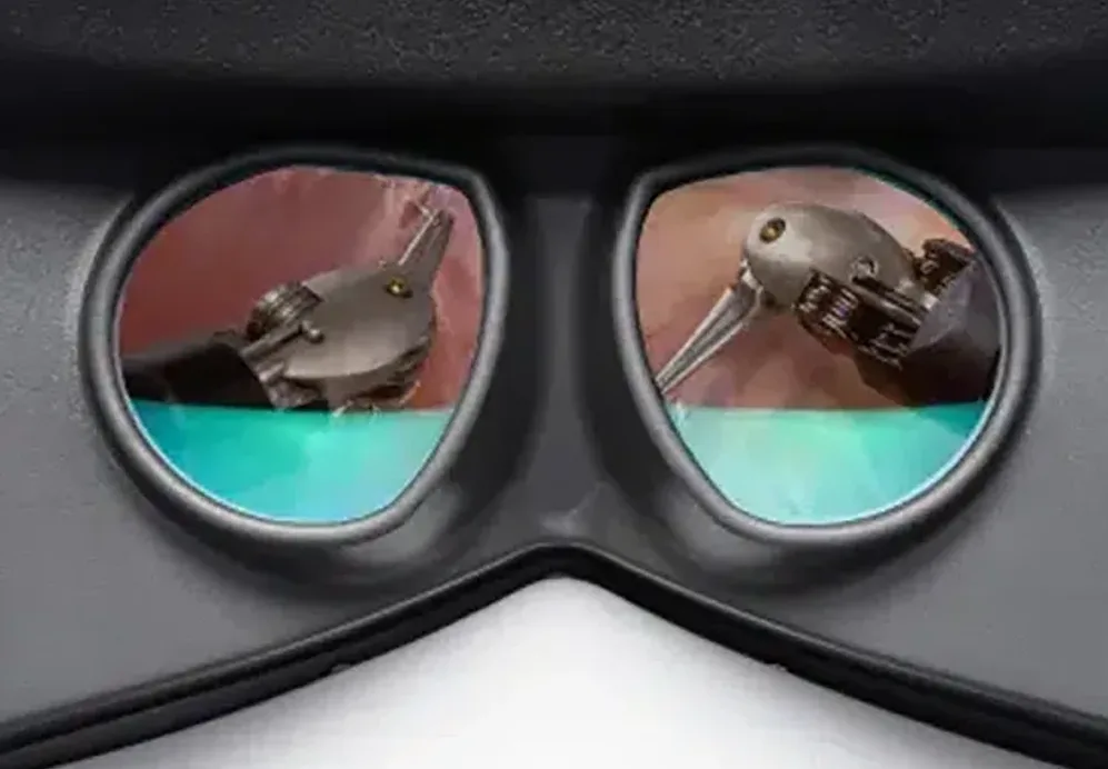 Image Of Viewers On Surgeon Console